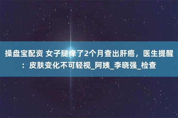 操盘宝配资 女子腿痒了2个月查出肝癌，医生提醒：皮肤变化不可轻视_阿姨_李晓强_检查